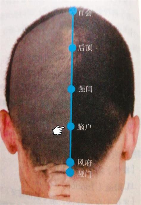 腦門穴|腦戶穴可改善頭暈,眩暈失眠,項強,口不能言